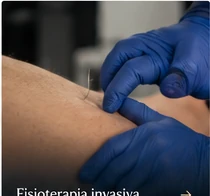 Técnicas de fisioterapia invasiva