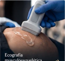 Ecografía musculoesquelética